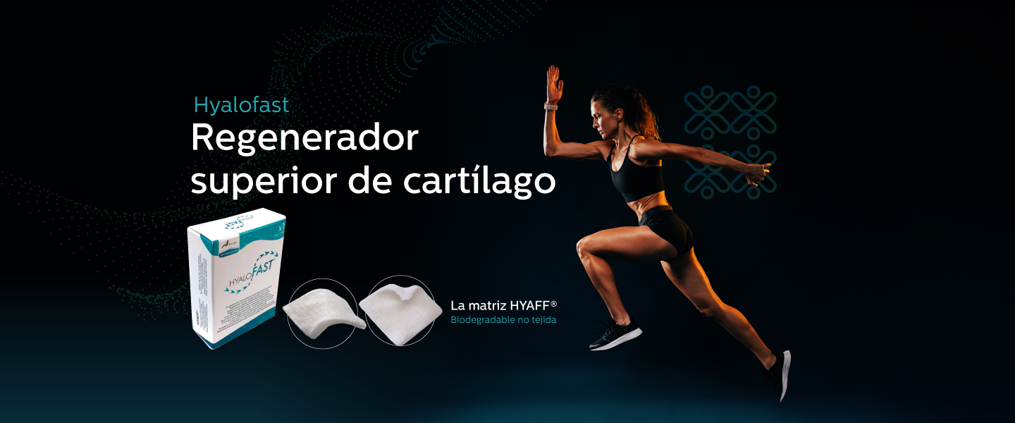 Sistema de fijación X-Twist